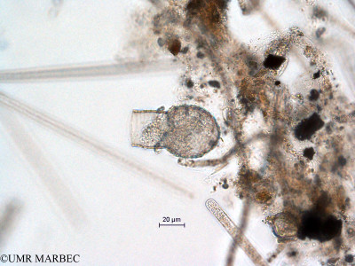 phyto/Scattered_Islands/all/COMMA April 2011/Codonellopsis morchella(copy)_thumb.jpg
